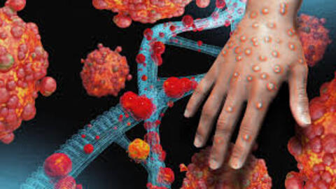 Đậu mùa khỉ không phải là dạng COVID-19 mới