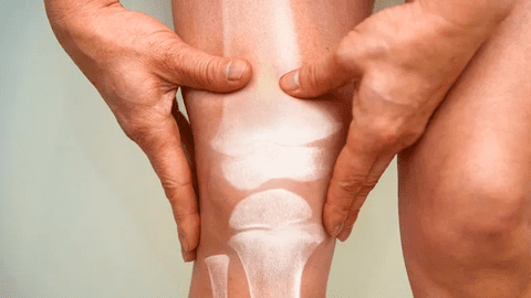 Hãy tránh xa 3 loại thực phẩm "cướp canxi" này, ăn càng nhiều xương càng giòn, dễ gãy