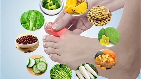 Những thực phẩm giúp giảm đau gout nhanh bạn cần biết