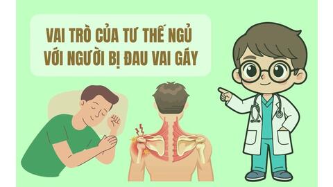 Thời điểm cần tập vật lý trị liệu khi đau vai gáy