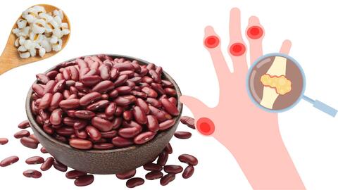 Món cháo hỗ trợ giảm axit uric, tốt cho người mắc bệnh gút