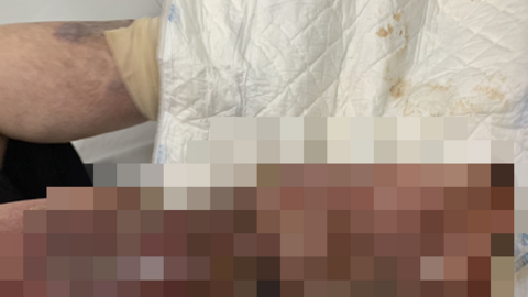 1 thói quen bức tử cơ quan nắm giữ sinh mệnh của cơ thể: Rất nhiều người Việt hồn nhiên làm mỗi ngày