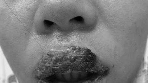 Tá hỏa vì môi biến dạng sau phun xăm làm đẹp đón Tết