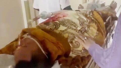 Làm rõ nguyên nhân bệnh nhân ăn tiết canh sau đó phải nhập viện