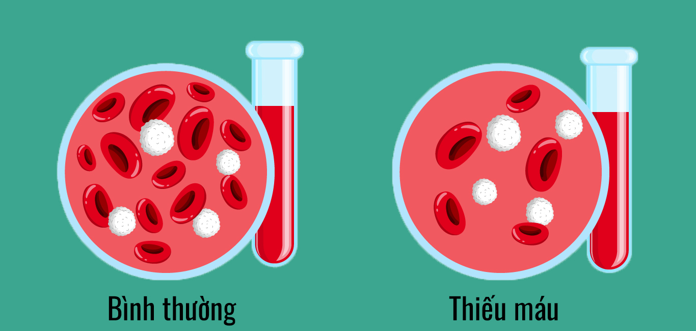 4 dấu hiệu cho thấy thận bắt đầu suy hỏng: Có 1 cũng cần đi khám ngay- Ảnh 1.