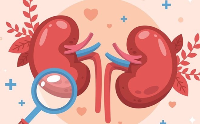 Phòng sỏi thận tự nhiên nhờ lựa chọn đồ uống đúng cách